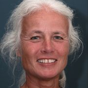 comment.user?.profileImg